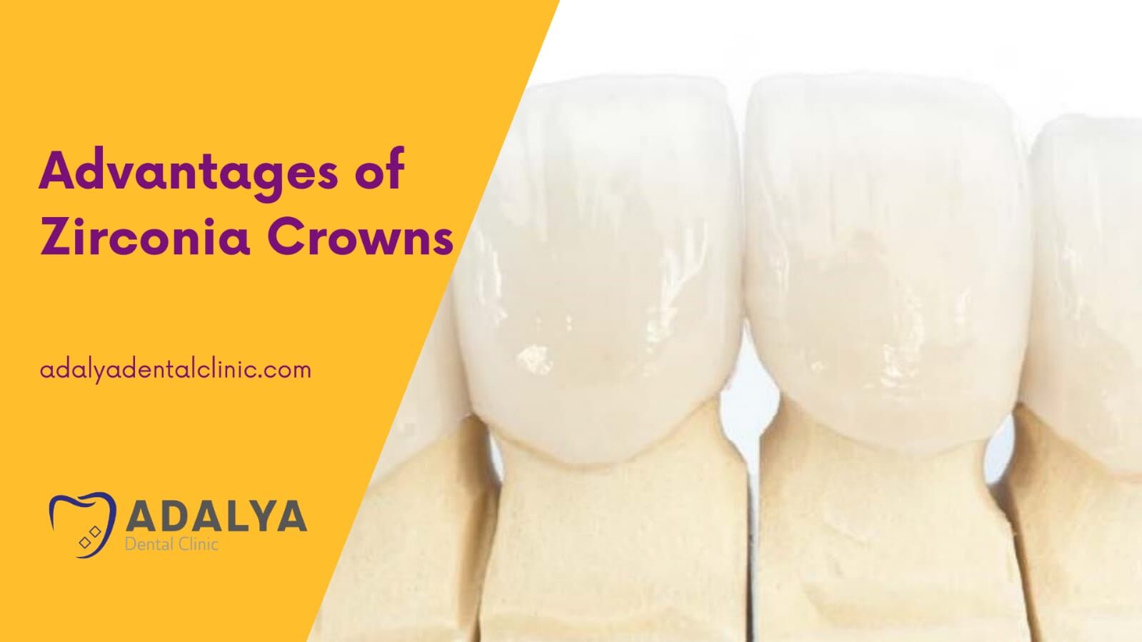 advantages of zirconia crowns