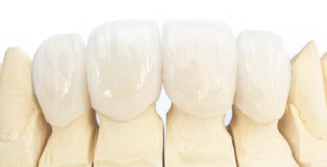 Zirconium Crown Turkey Antalya Cost Price