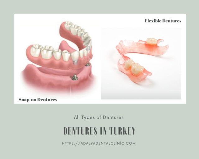 dentures-in-turkey-cost dentures in turkey cost