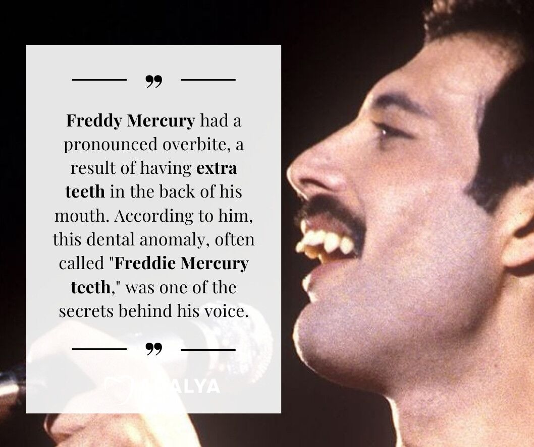 Freddie Mercury Teeth The Unique Story of Mercury's Teeth
