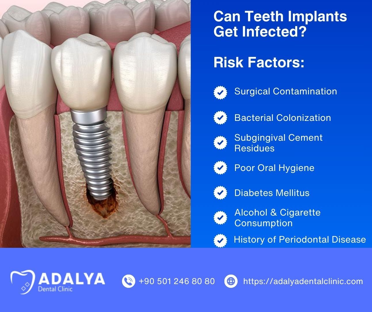 can teeth implants get infected