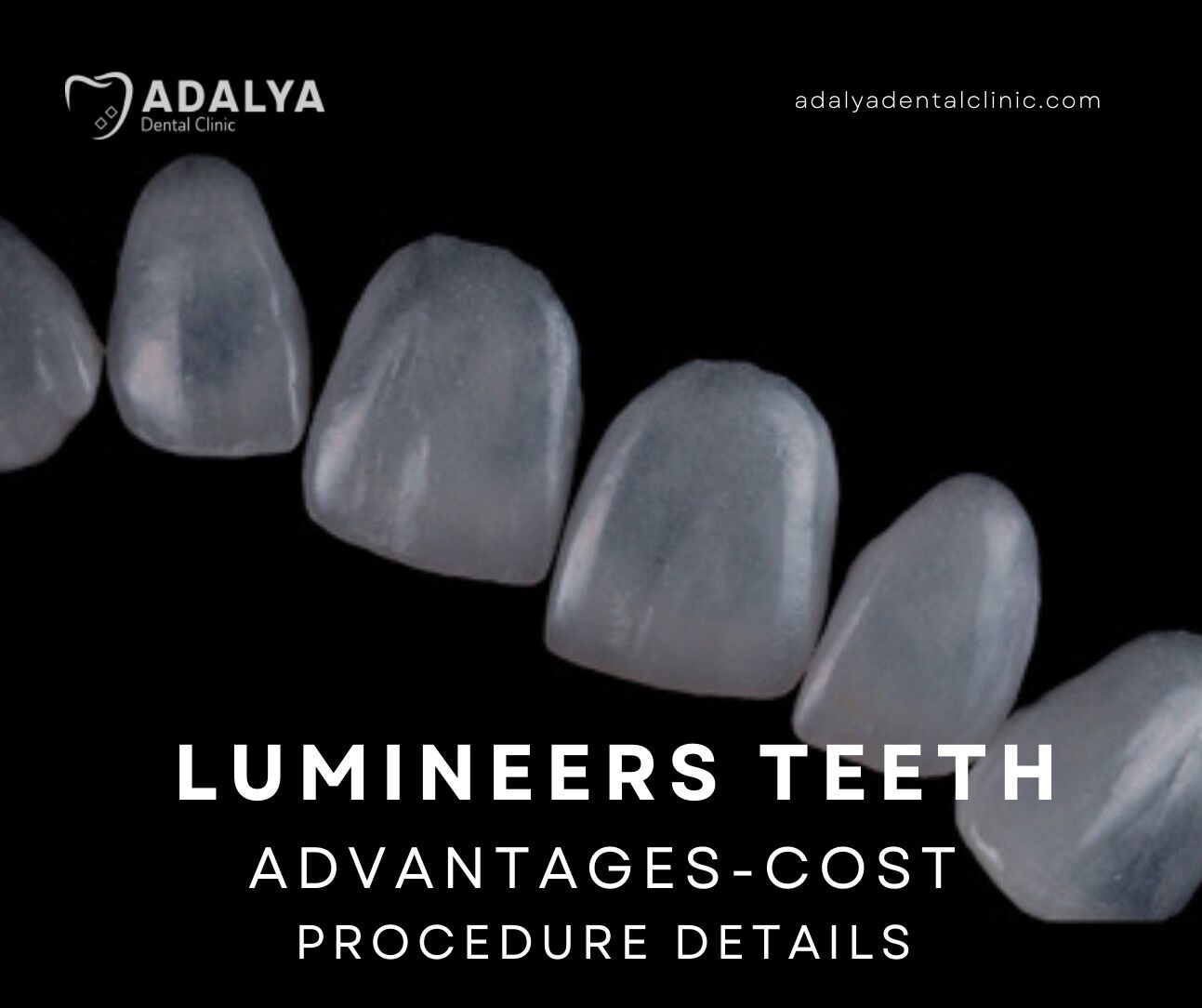 lumineers teeth