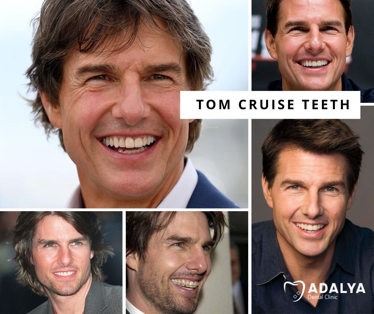 tom cruise teeth