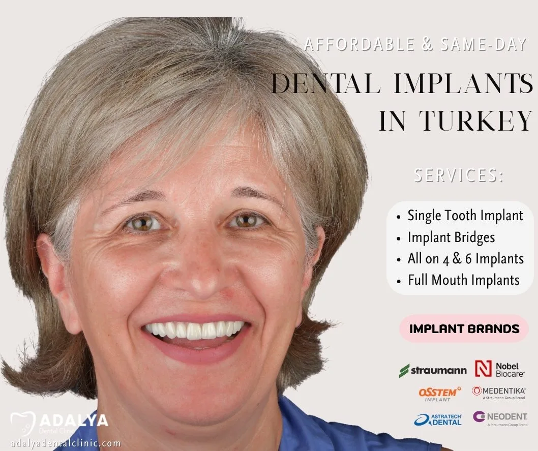 dental implants turkey